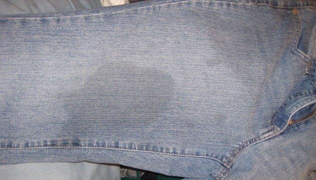 How to remove greasy stains on pants with store-bought remedies